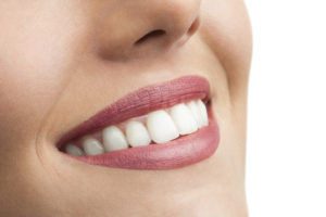 Richmond Road Dental Smile