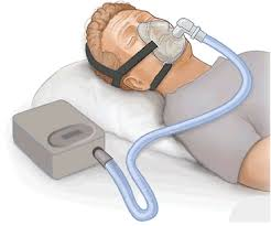 Richmond Road Dental Snoring