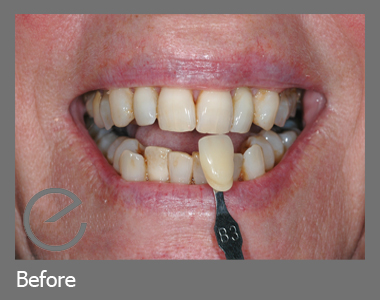 Richmond Road Dental Enlighten
